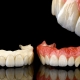 Dentalfotografie für Ihre Praxis
